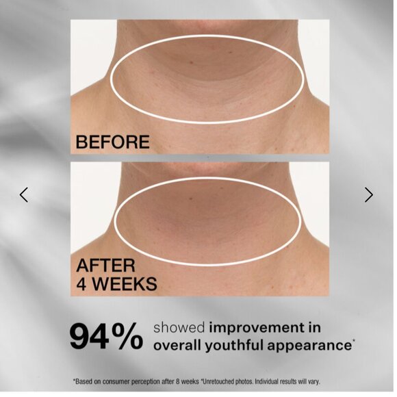 NEW! StriVectin TL Advanced Tightening Neck Cream Plus, 1 oz, 2-pack - Picture 7 of 9